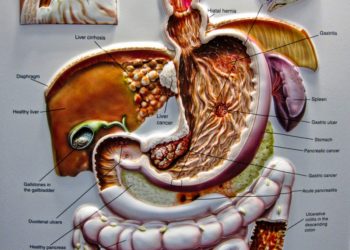 Aranyér és az aranyérbetegség