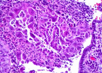 Ajakherpesz tünetei, kezelése